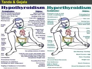 Bagaimana Cara Membedakan Hipertiroid Dan Hipotiroid
