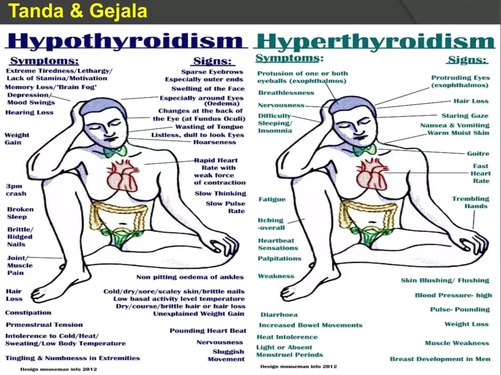 Bagaimana Cara Membedakan Hipertiroid Dan Hipotiroid