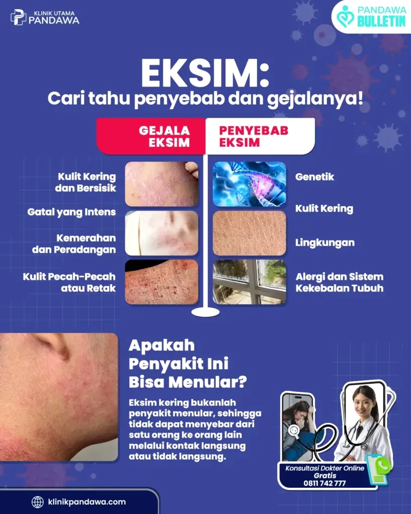Bagaimana Cara Mengatasi Eksim Yang Gatal Dan Perih