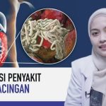 Bagaimana Cara Mengobati Infeksi Cacingan Pada Orang Dewasa
