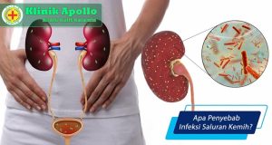 Bahaya Mengabaikan Isk Kenali Dampak Buruknya Bagi Kesehatan Tubuh
