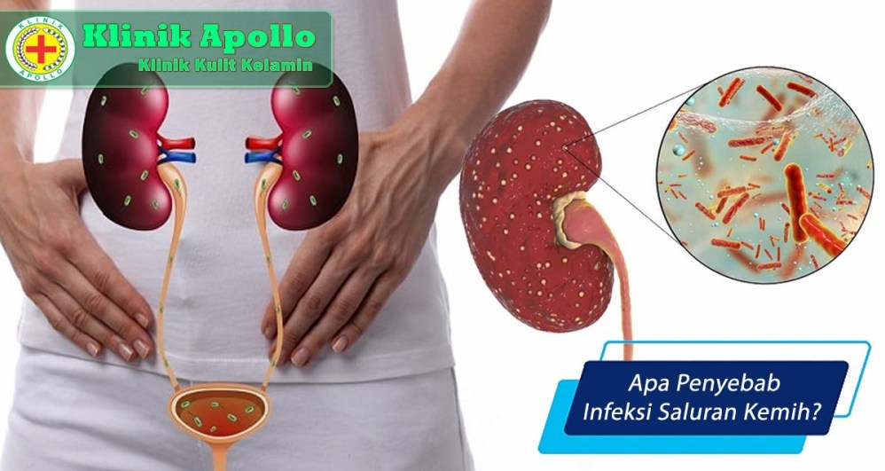Bahaya Mengabaikan Isk Kenali Dampak Buruknya Bagi Kesehatan Tubuh