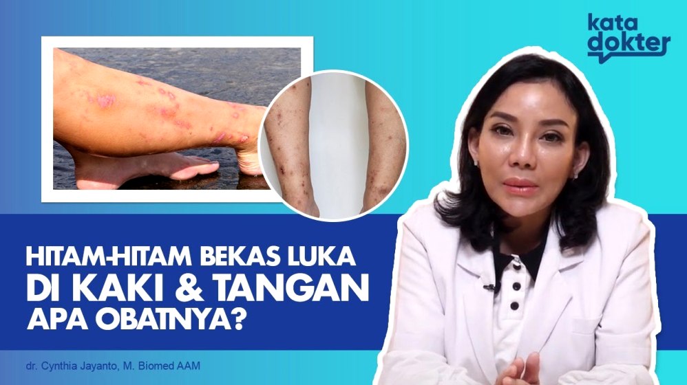Kenapa Kulit Menimbulkan Bekas Hitam Setelah Digaruk