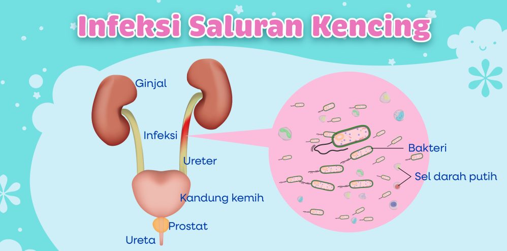 Kenapa Urine Berbau Menyengat Memahami Penyebab Gejala Dan Cara Mengatasinya