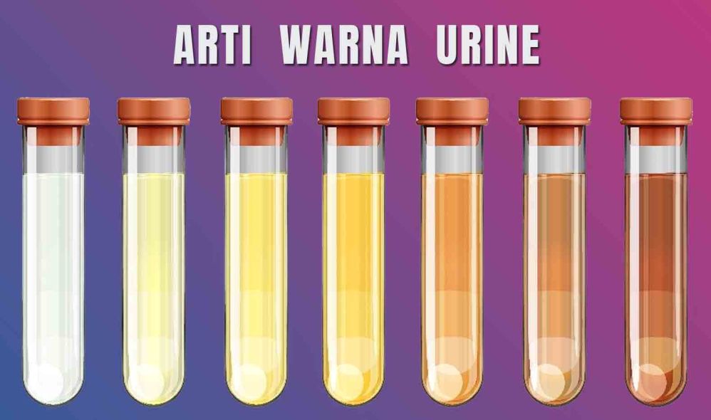 Kenapa Urine Berwarna Gelap Atau Seperti Teh