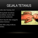 Memahami Ancaman Senyap Apa Bahaya Penyakit Tetanus Jika Tidak Diobati