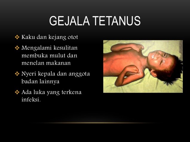 Memahami Ancaman Senyap Apa Bahaya Penyakit Tetanus Jika Tidak Diobati