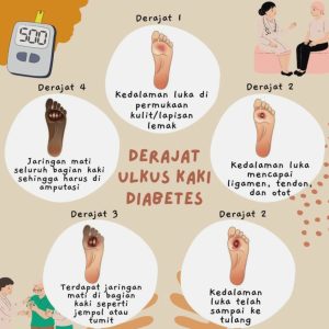 Mengenal Bahaya Komplikasi Diabetes Pada Kaki Gejala Pencegahan Dan Penanganannya