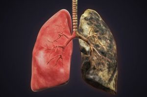 Panduan Lengkap Bagaimana Cara Merawat Paru Paru Yang Sudah Terkena Rokok Secara Natural