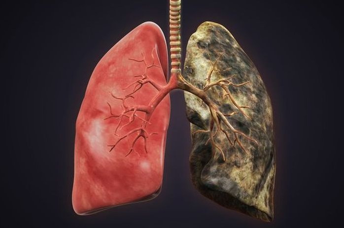 Panduan Lengkap Bagaimana Cara Merawat Paru Paru Yang Sudah Terkena Rokok Secara Natural
